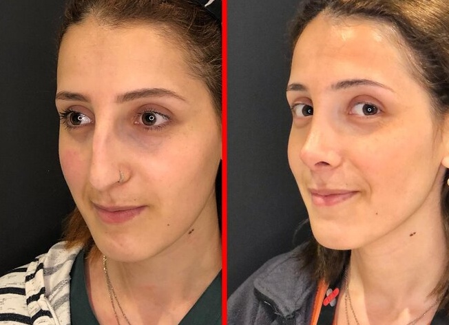 Как подобрать макияж и прическу под форму носа у девушек