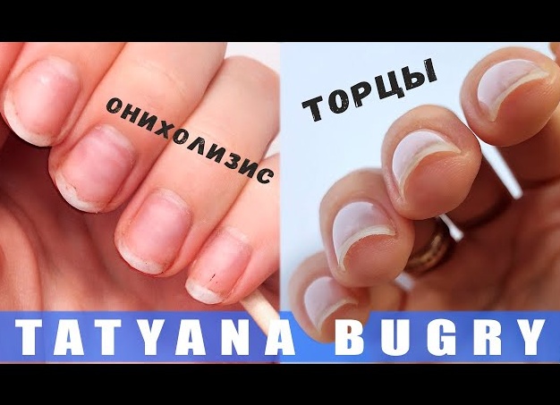Полезные советы по запечатыванию торца ногтя гель лаком в домашних условиях